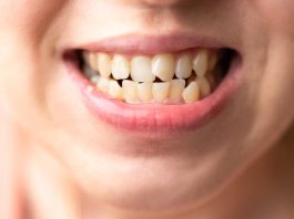 Pourquoi les dents jaunissent ?